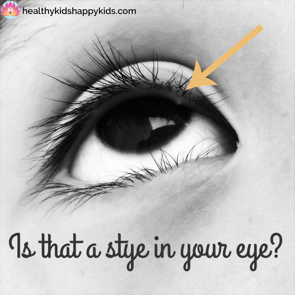 Is that a stye in your eye?