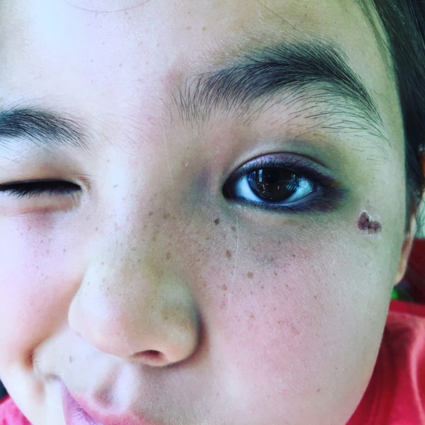 Look at that shiner!